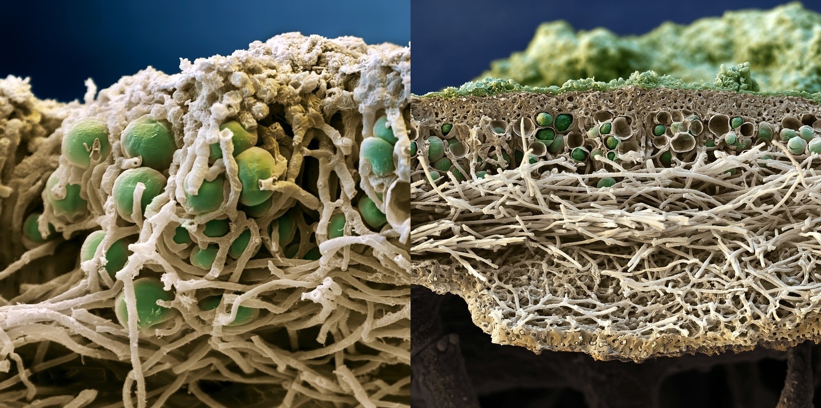 Микроскопом лишайник. Лишайник микроскоп. Клетки лишайника под микроскопом. Строение лишайника под микроскопом. Срез лишайника под микроскопом.