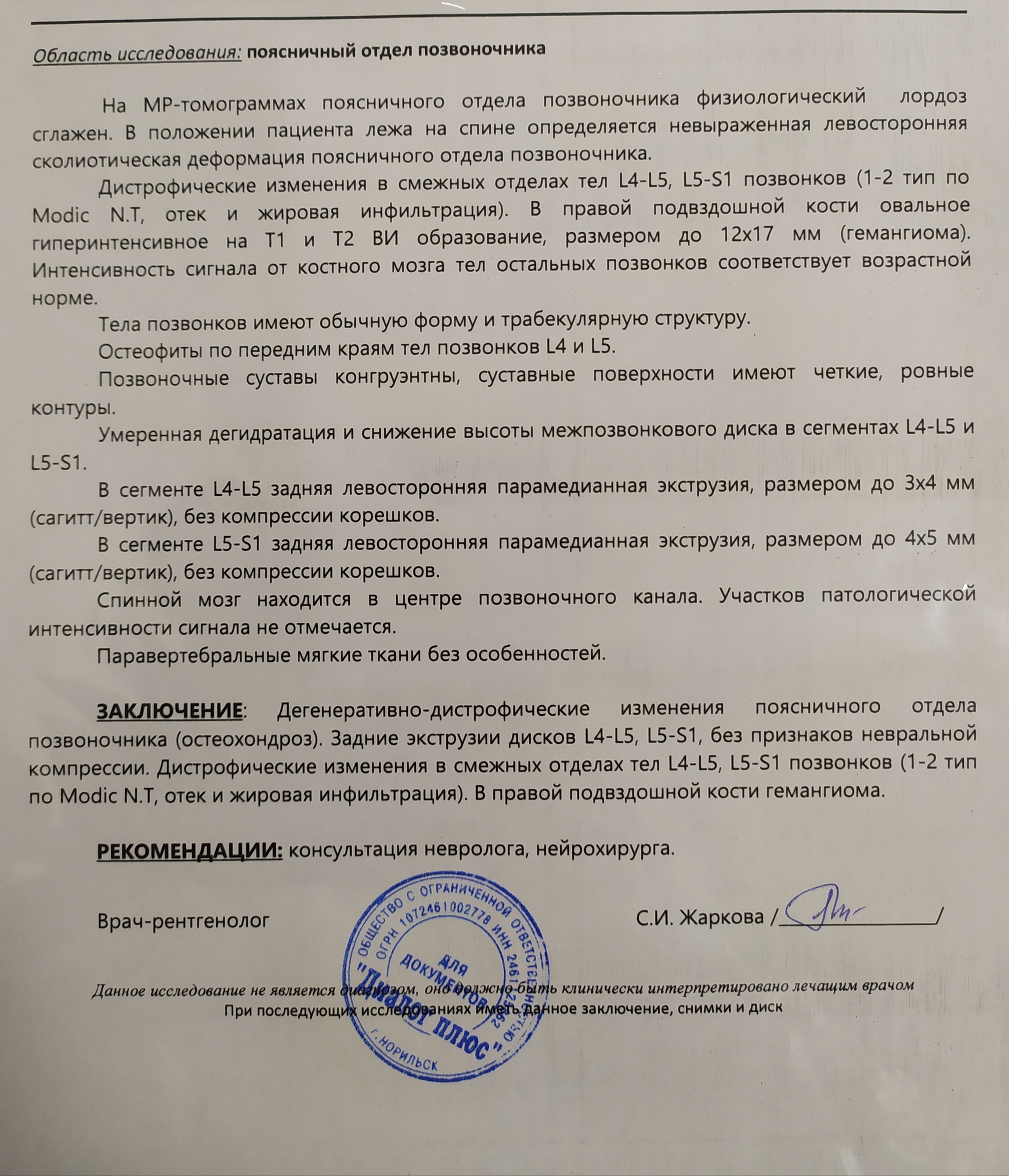 МРТ поясничного отдела позвоночника | Пикабу