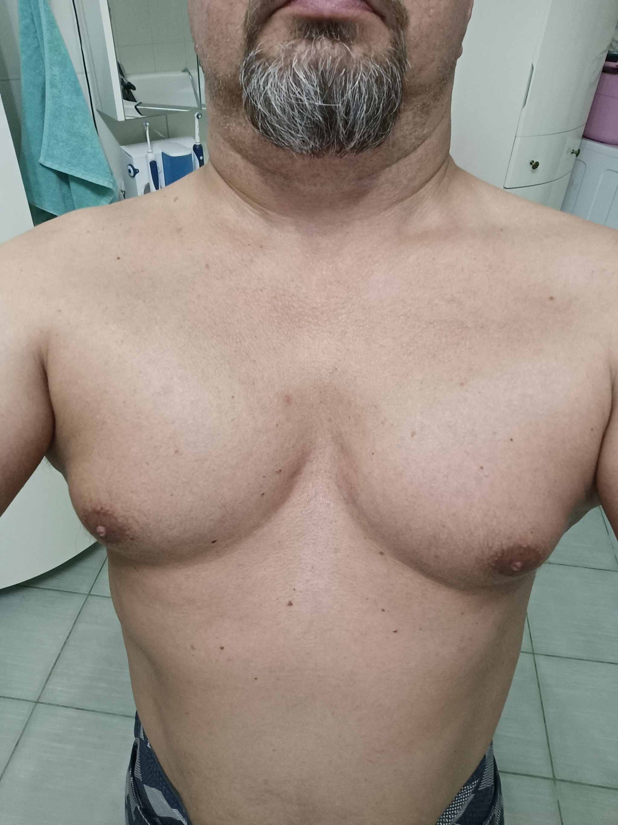 Фото До и После уменьшения груди, результаты работ