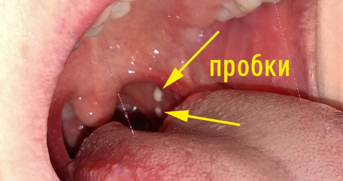 Лечение вагинального зуда в Калининграде — Медцентр 