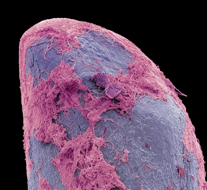 Использованная зубная щётка под микроскопом | Пикабу