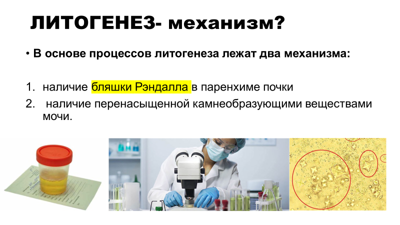 Мочекаменная болезнь - симптомы, признаки, виды и лечение у мужчин и женщин в Москве в «СМ-Клиника»