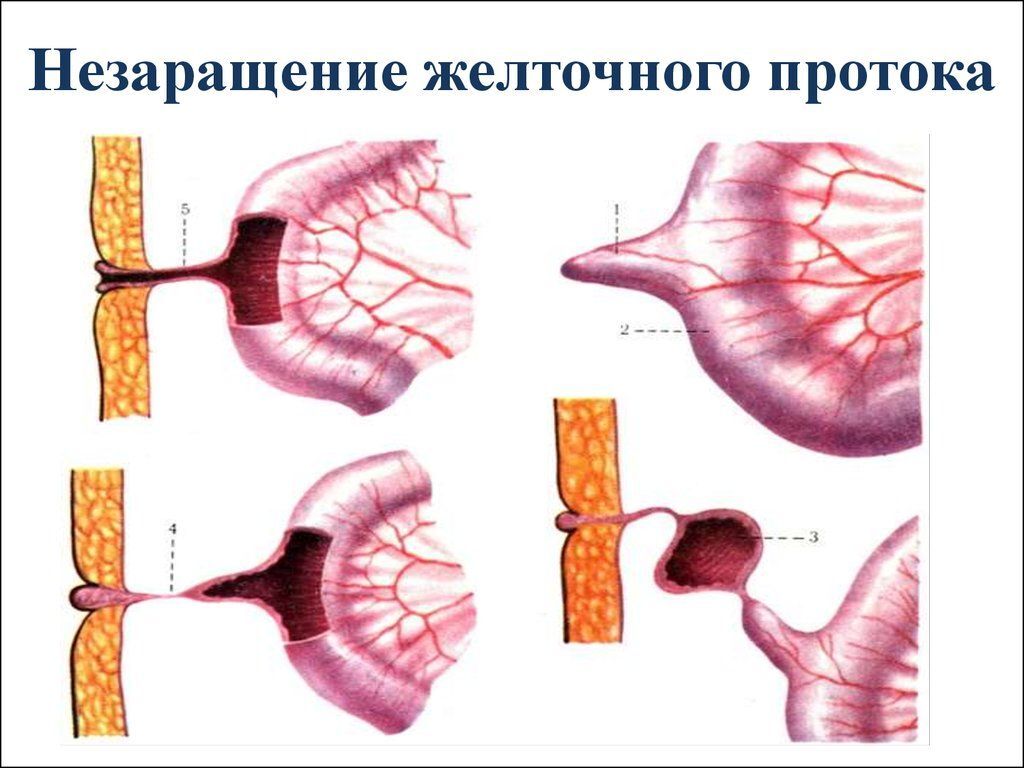 Уход за пупочной ранкой | Пикабу