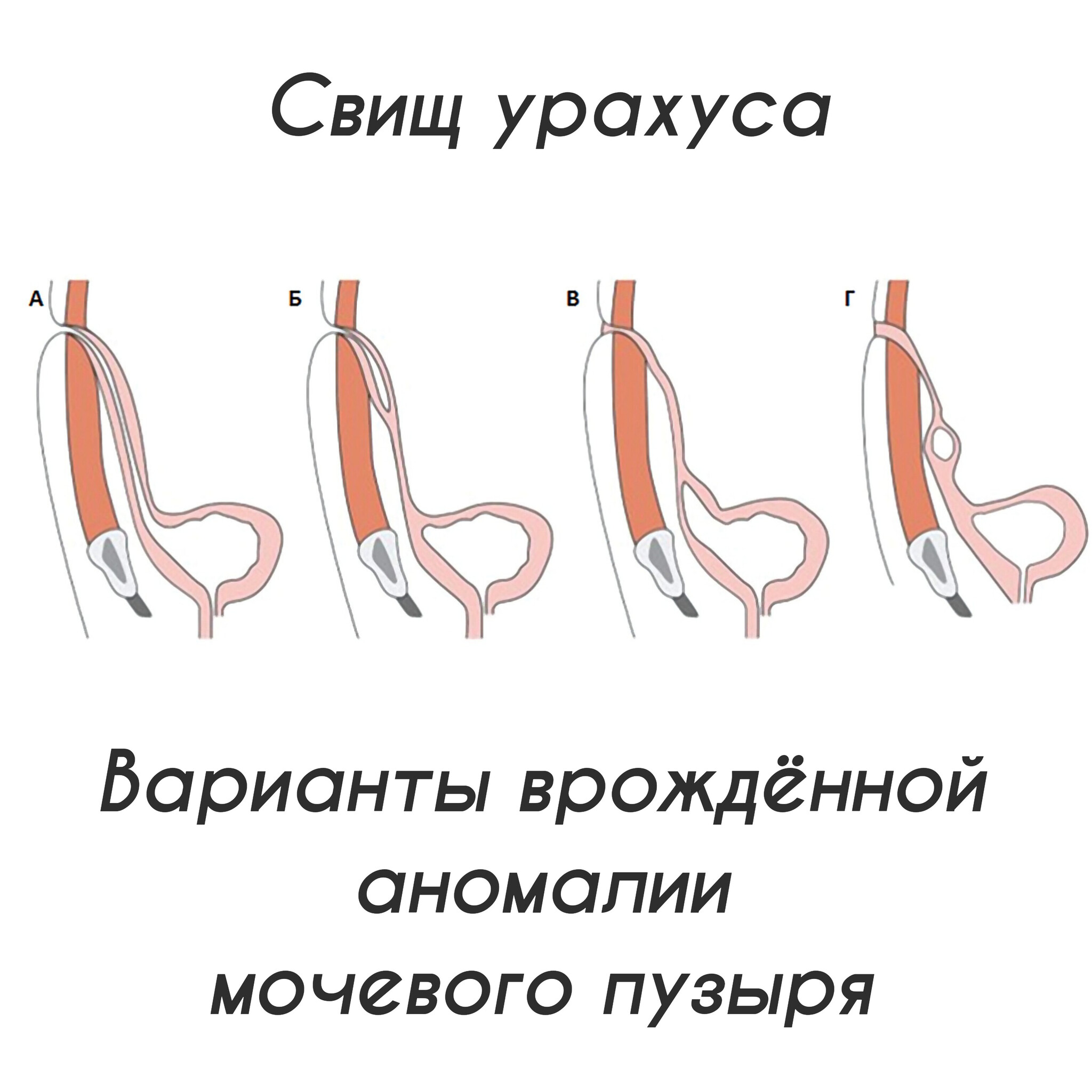 Уход за пупочной ранкой | Пикабу