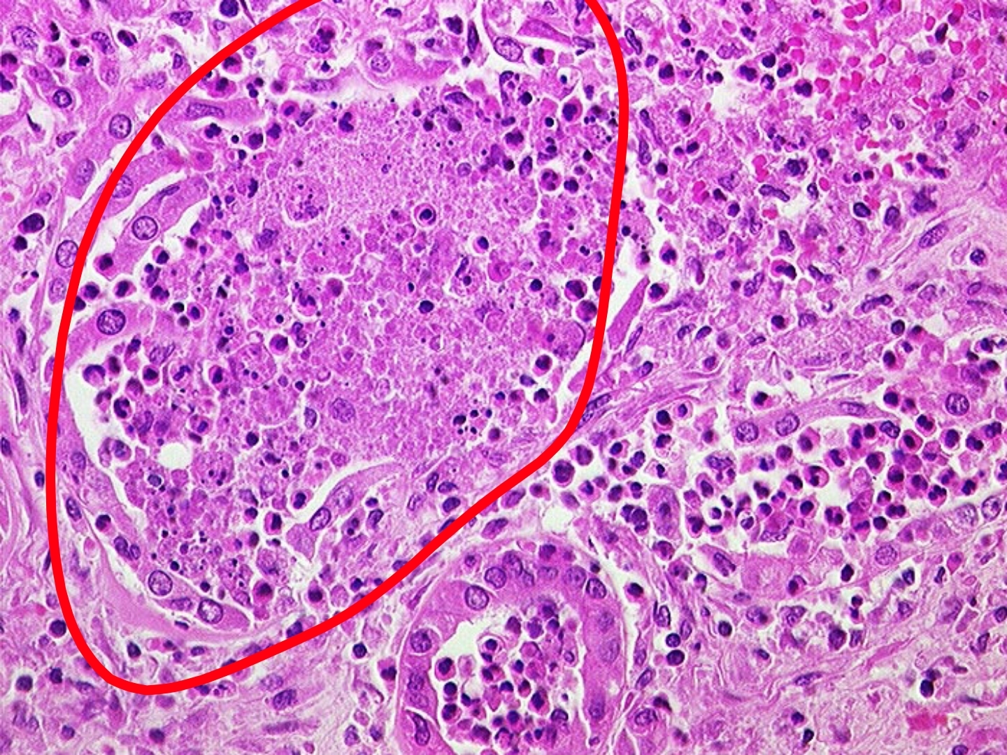 Патологическая анатомия для самых маленьких (выпуск 2) | Пикабу