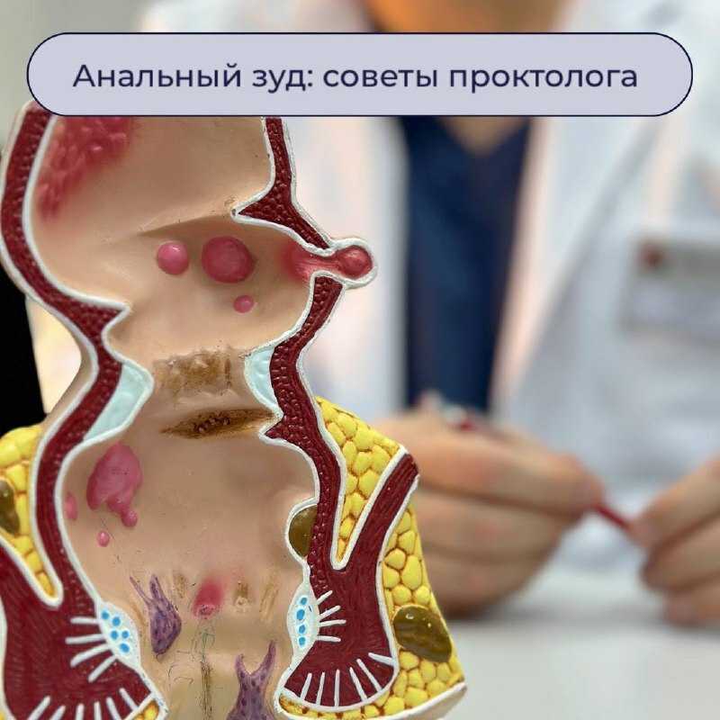 Анальный зуд - боль в заднем проходе: причины и лечение в Оксфорд Медикал Киев