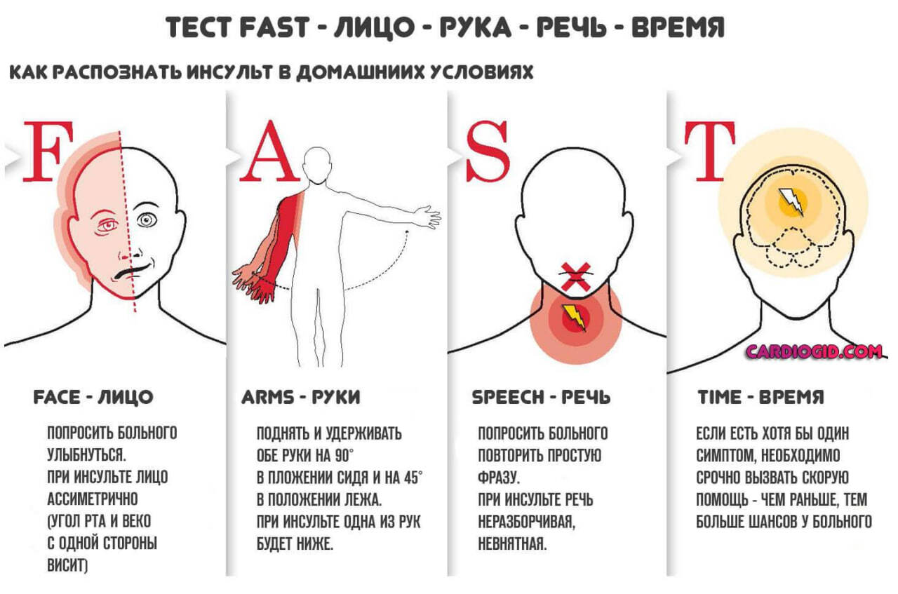 Инсульт - Острое нарушение мозгового кровообращения. Что это? Виды  инсультов. Как распознать и не потерять время? | Пикабу