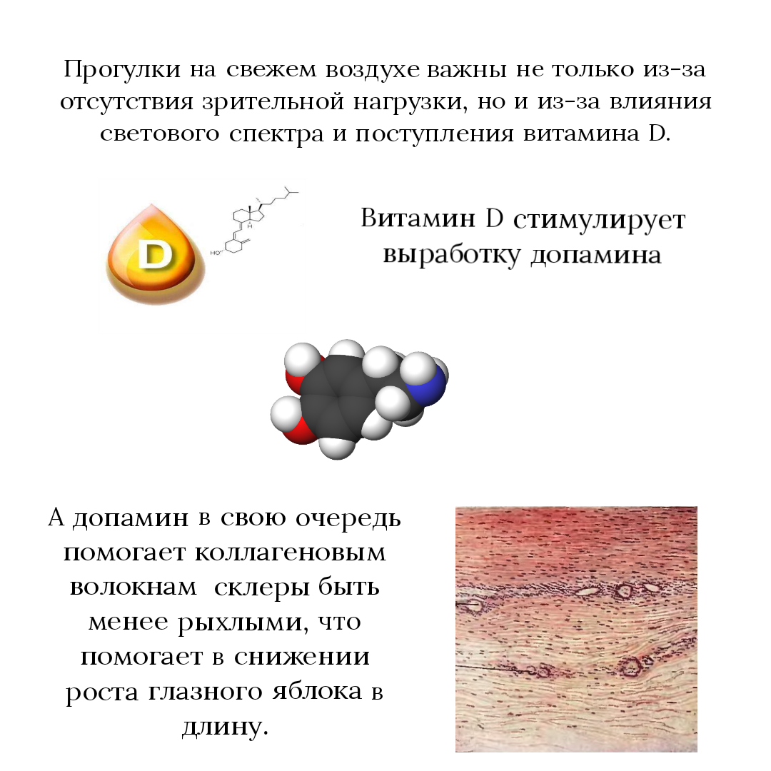 Близорукость (миопия) | Пикабу