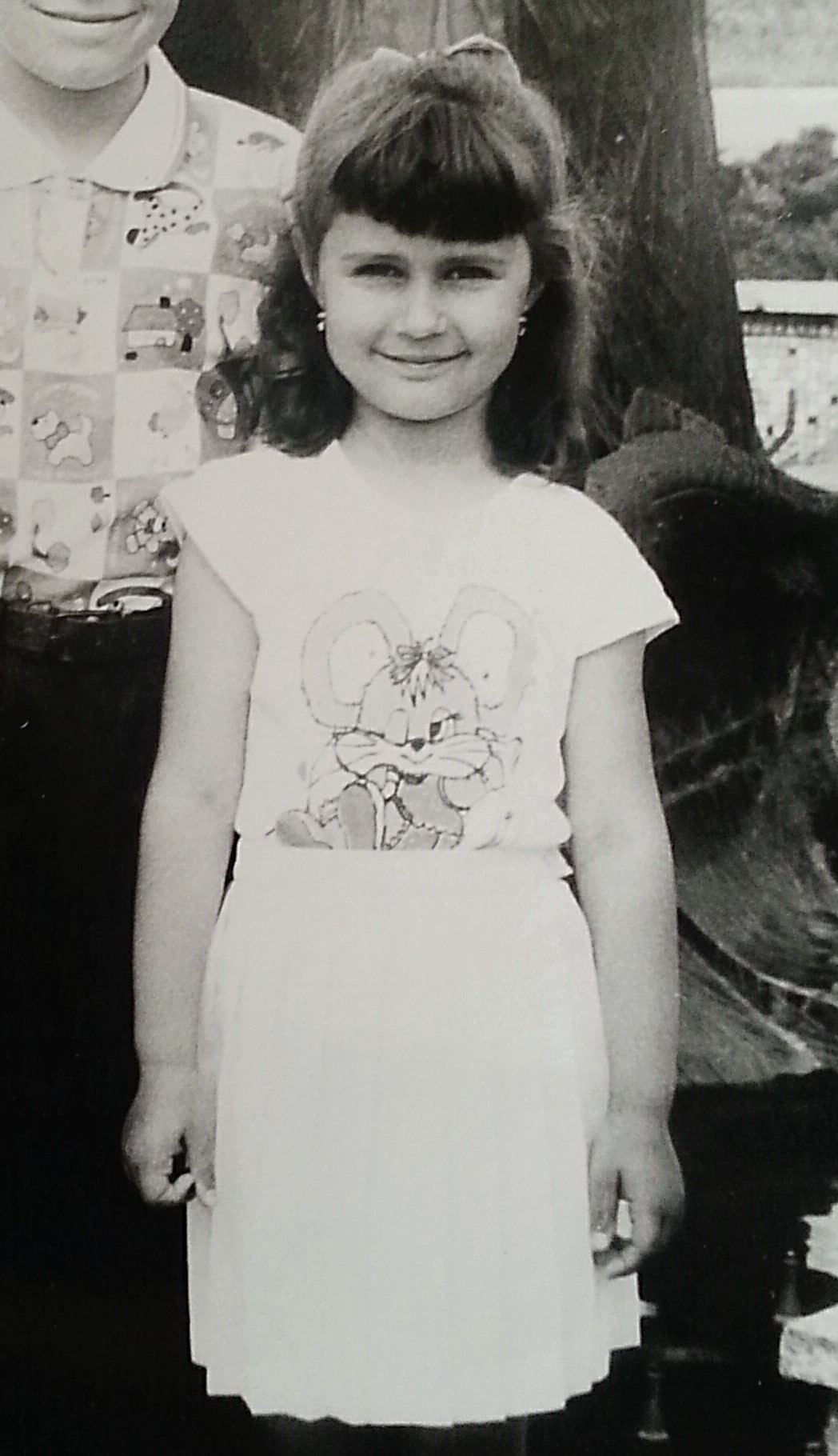 Сколиоз с детства (длиннопост) | Пикабу